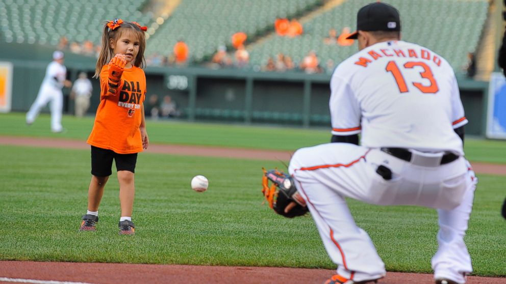 5-Year-Old Throws Orioles Opening Pitch with 3D Printed Prosthetic Hand (3dprintingindustry.com)