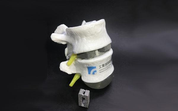 China FDA calls for professional guidance on 3D printed medical devices (3dprintingindustry.com)